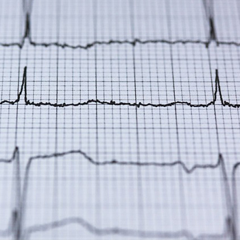 ekg EKG